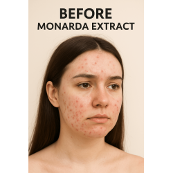 Siberian Monarda Oil – CO₂ Extract | Anti-Fungal, Anti-Acne | Organic & Powerful