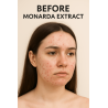 Siberian Monarda Oil – CO₂ Extract | Anti-Fungal, Anti-Acne | Organic & Powerful