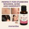 Siberian Monarda CO2 Extract 30ml – Natural Skin, Nail & Scalp Remedy Oil fromUS