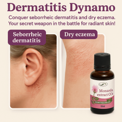 Siberian Monarda CO2 Extract 30ml – Natural Skin, Nail & Scalp Remedy Oil fromUS